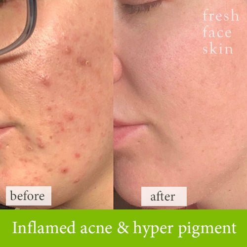 Hydration Booster - Fresh Face Skin