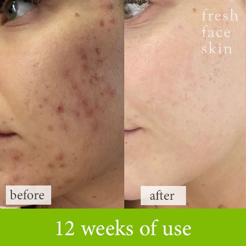 Renewal Booster - Fresh Face Skin