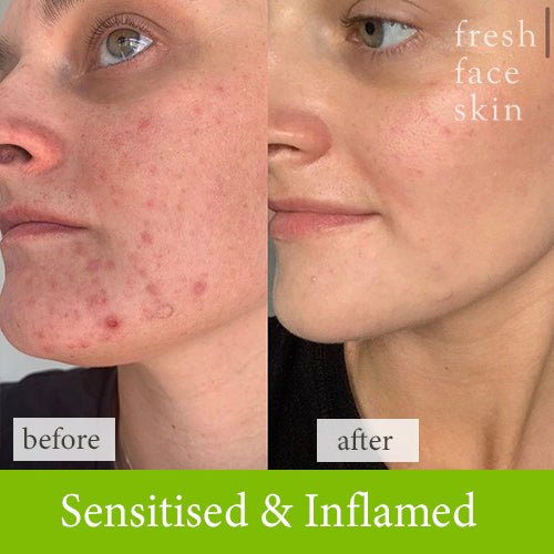 Hydration Booster - Fresh Face Skin