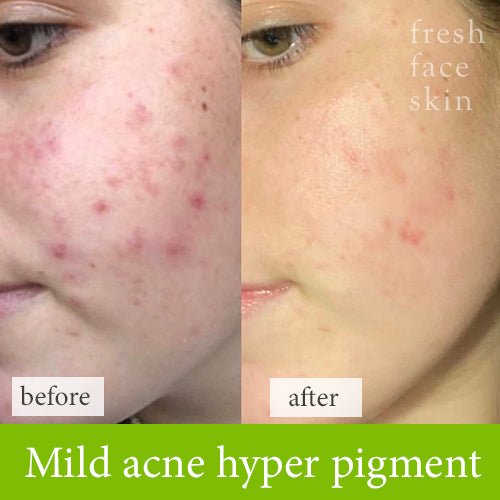 Reverser Cleanser - Fresh Face Skin