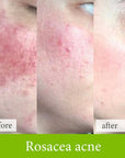 Soother Treatment - Fresh Face Skin