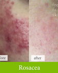 Soother Treatment - Fresh Face Skin