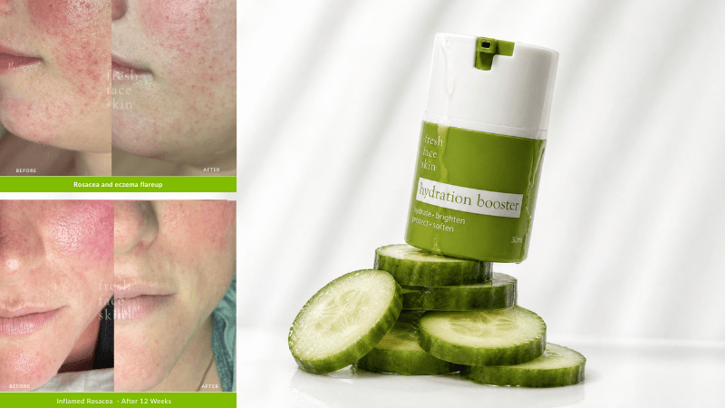 Hydration Without Overwhelming the Skin: Why Thoughtful Formulation Matters - Fresh Face Skin