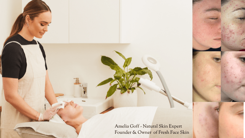 Skincare in Your 20s: Building the Foundation for Healthy, Radiant Skin - Fresh Face Skin