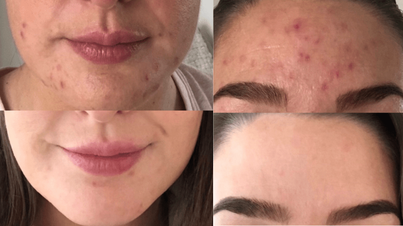 The Hidden Dangers of Single Actives: Are You Sabotaging Your Skin? - Fresh Face Skin