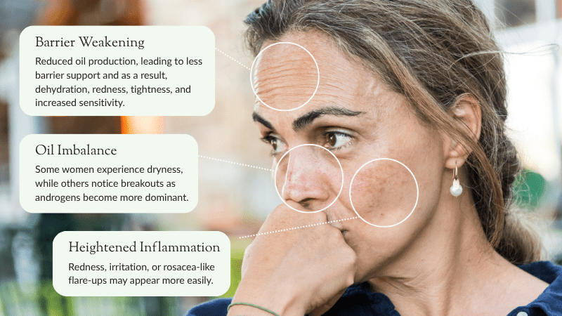 Understanding Skin Changes During Perimenopause and Menopause - Fresh Face Skin