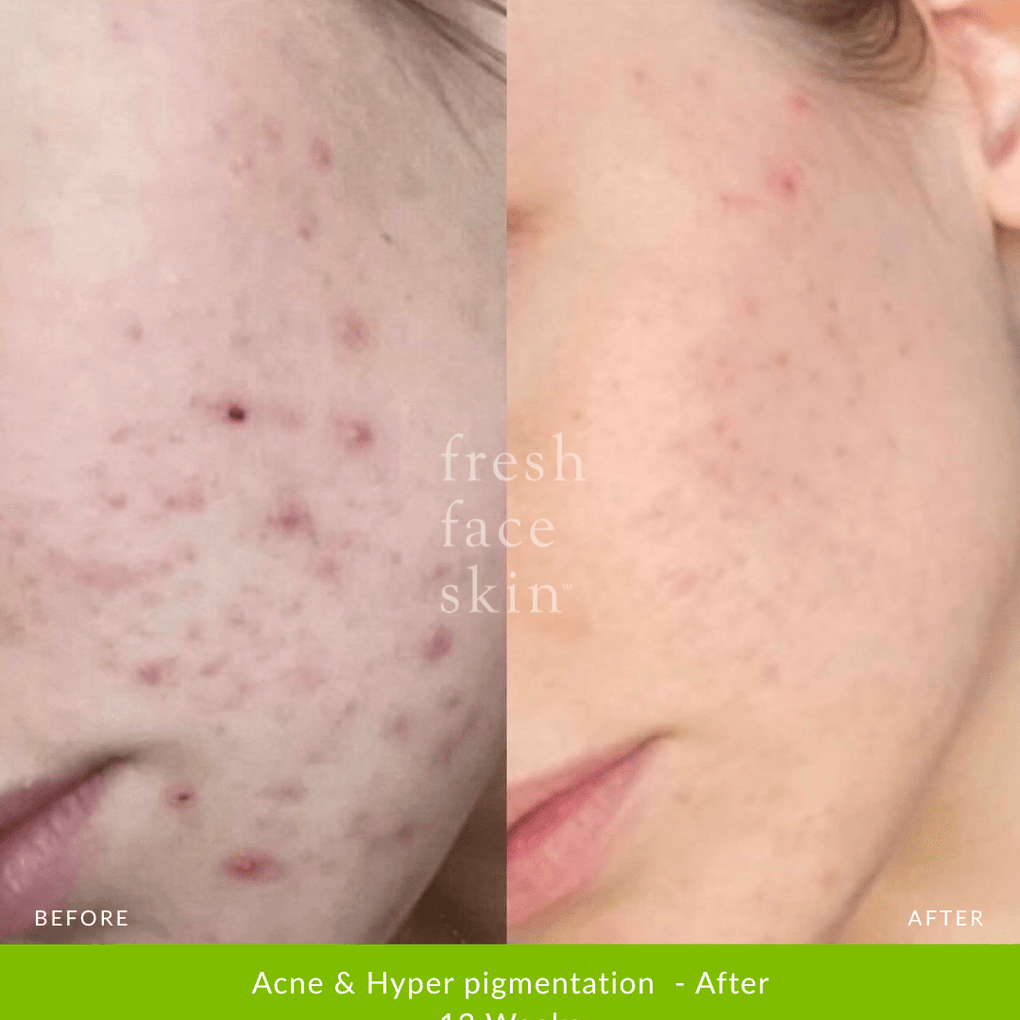 Healer Cleanser - Fresh Face Skin