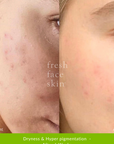 Reverser Treatment