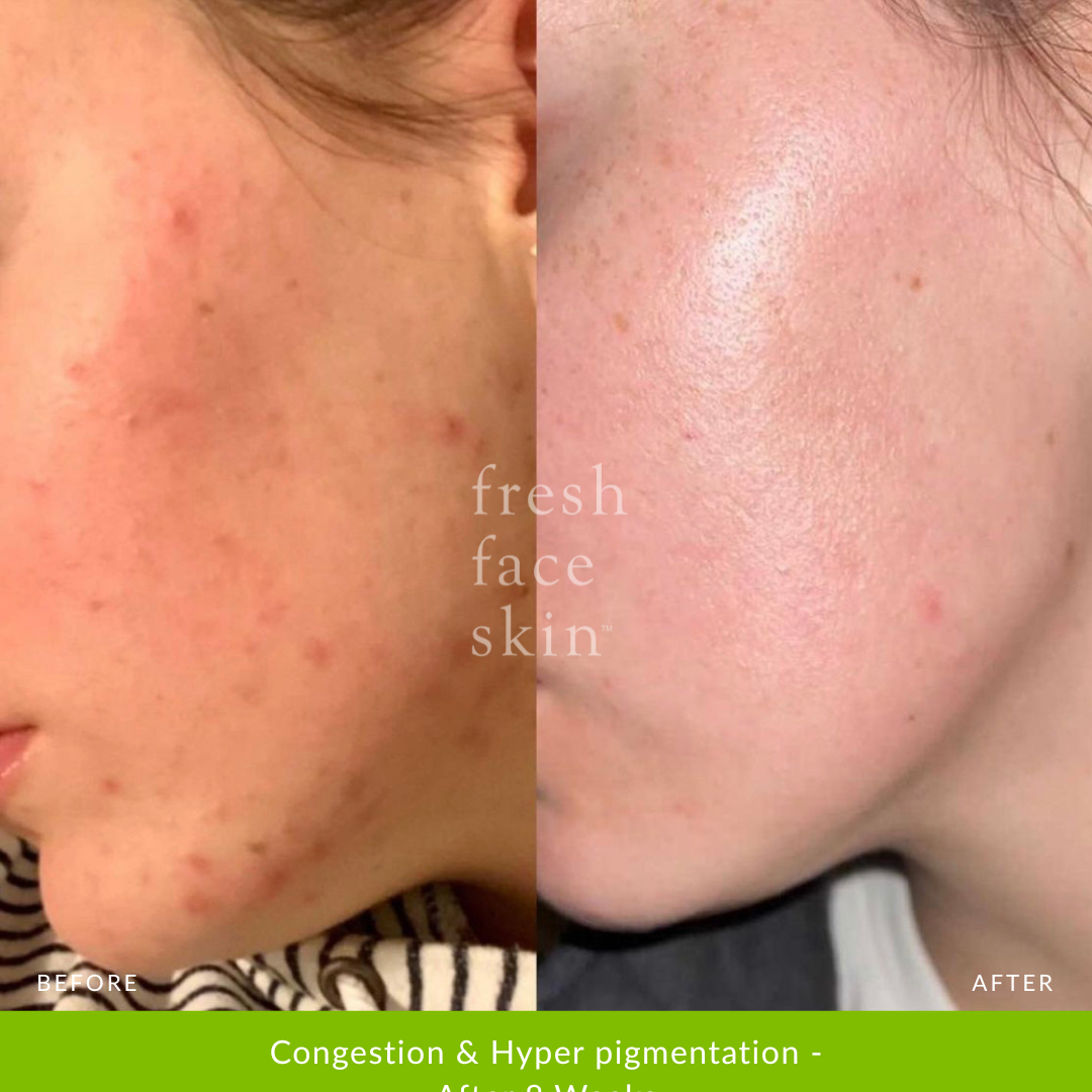 Skin Barrier Repair Pack