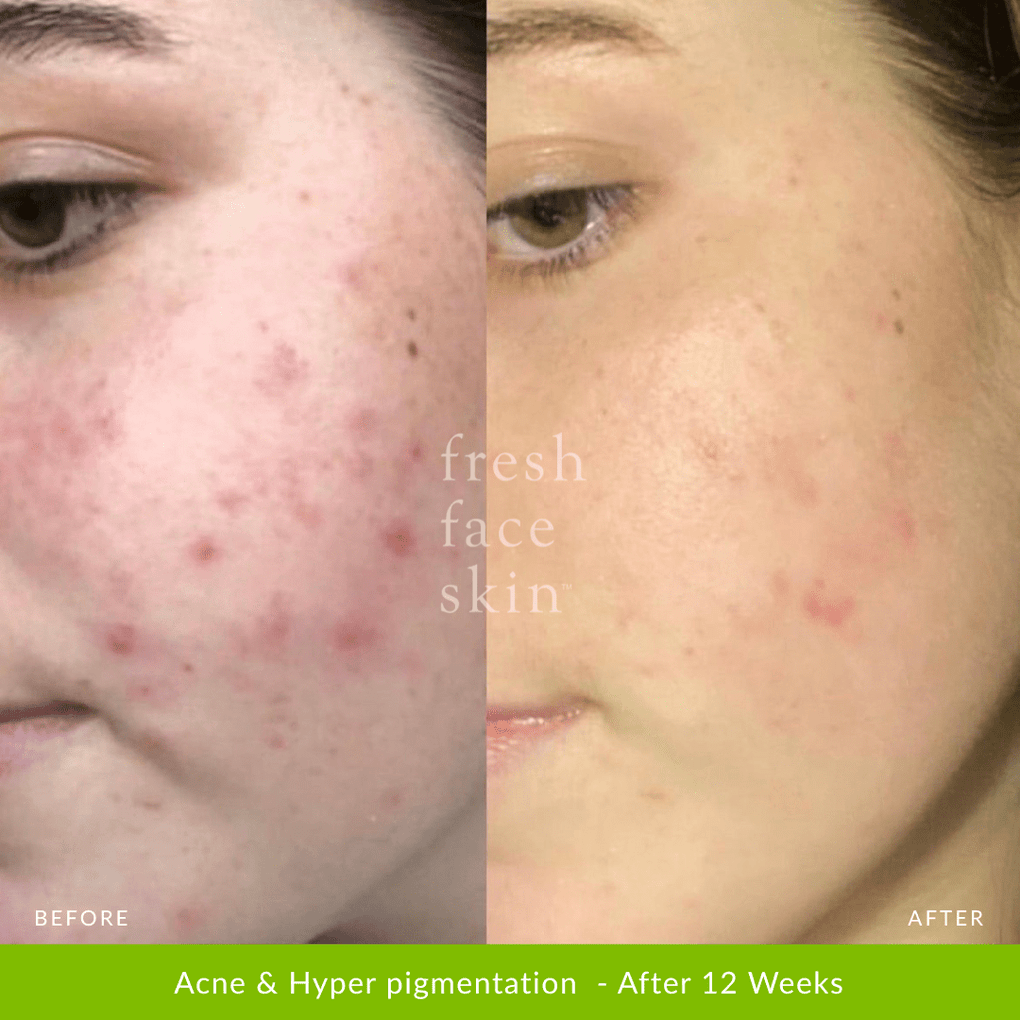 Healer Cleanser - Fresh Face Skin