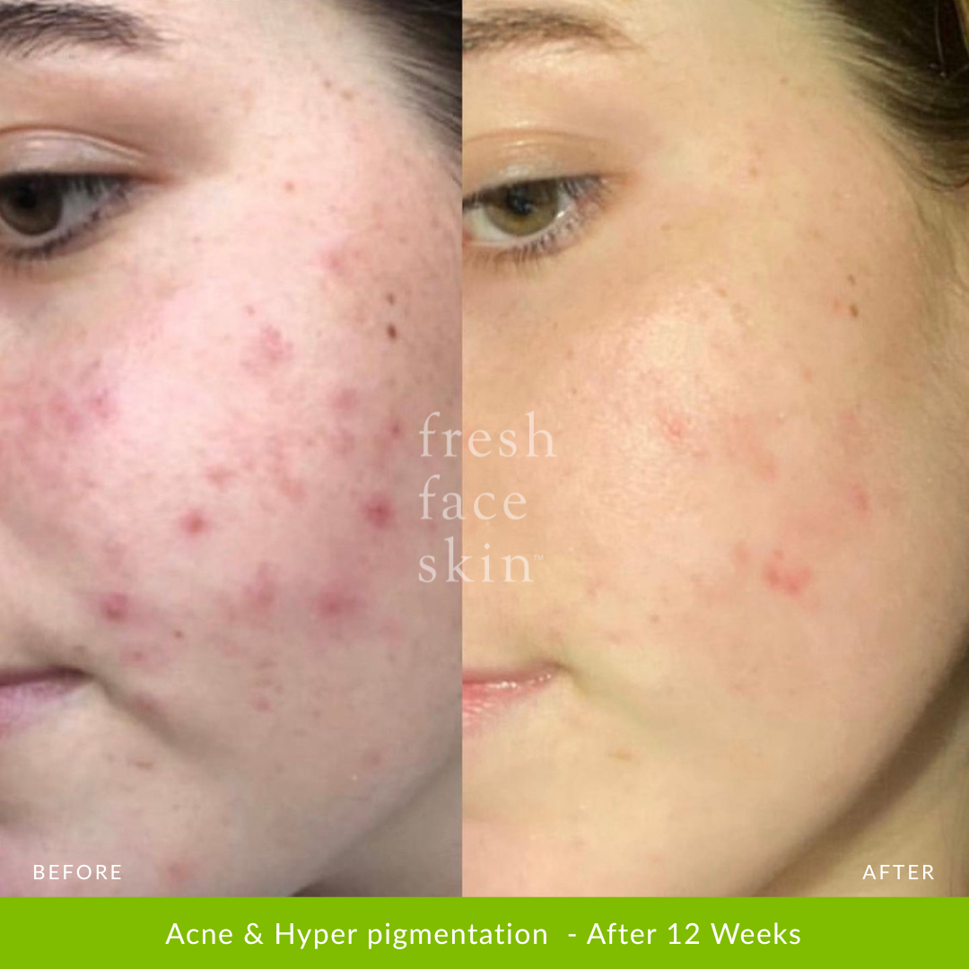 Healer Cleanser