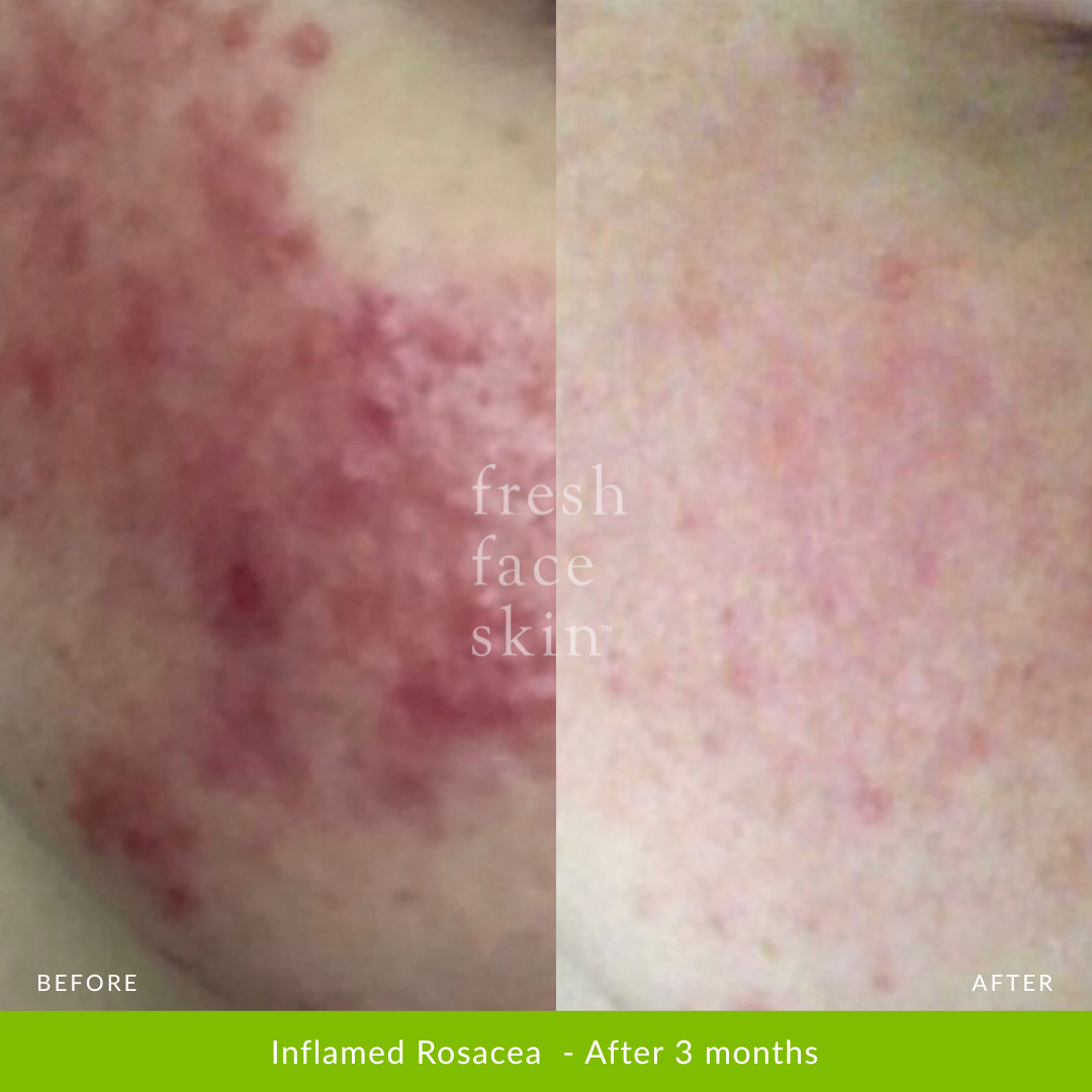 Skin Barrier Repair Pack