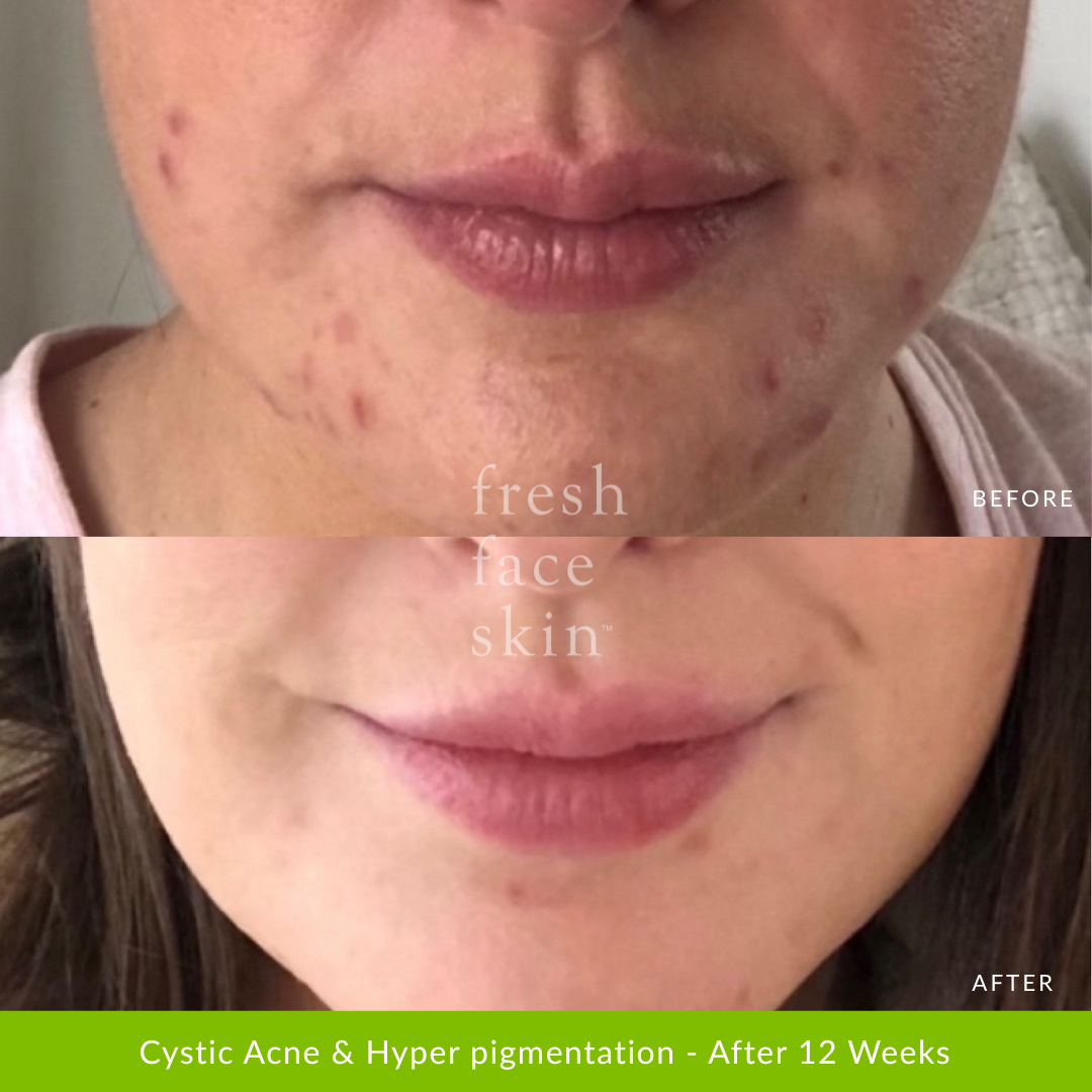 Healer Cleanser