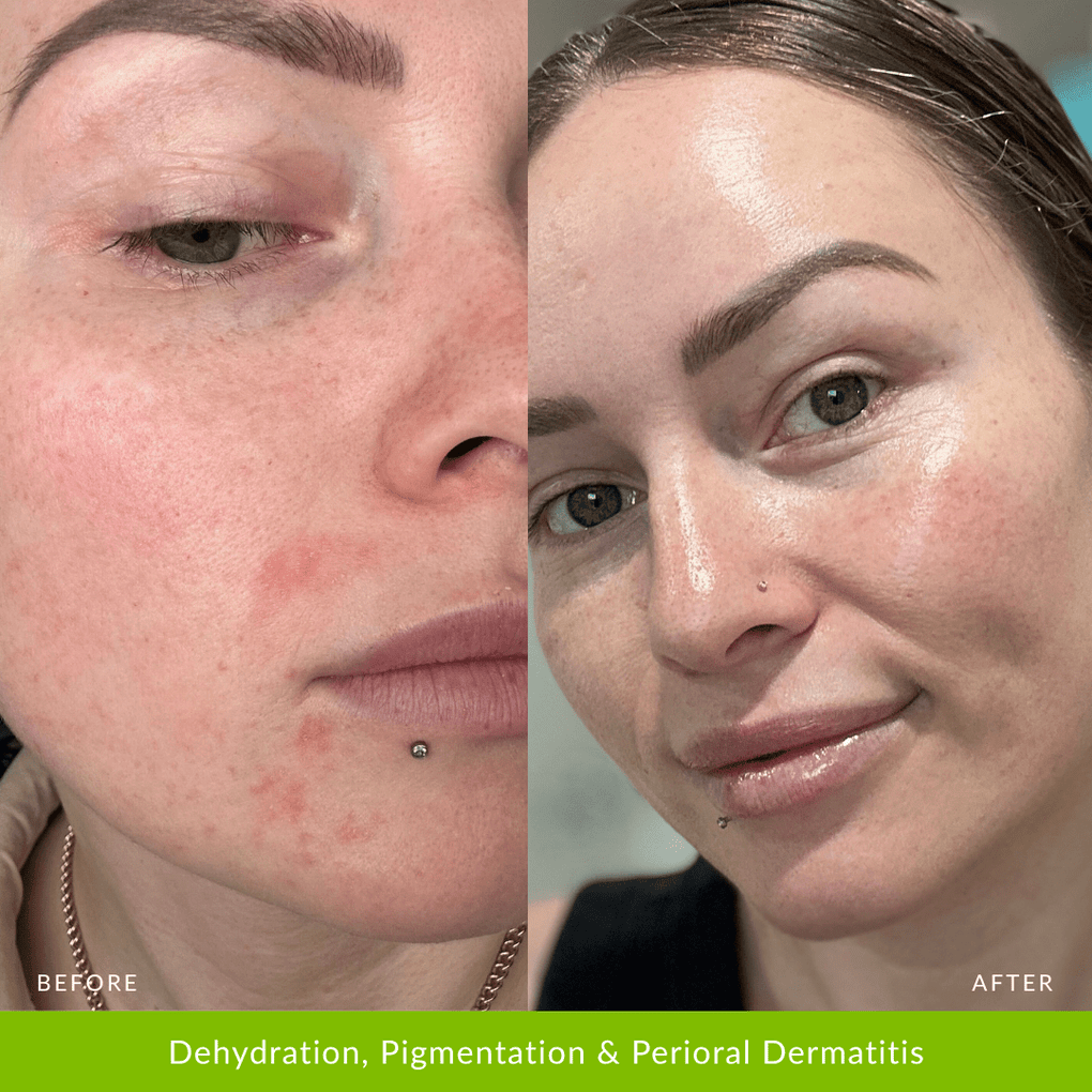 Hydration Duo - Fresh Face Skin