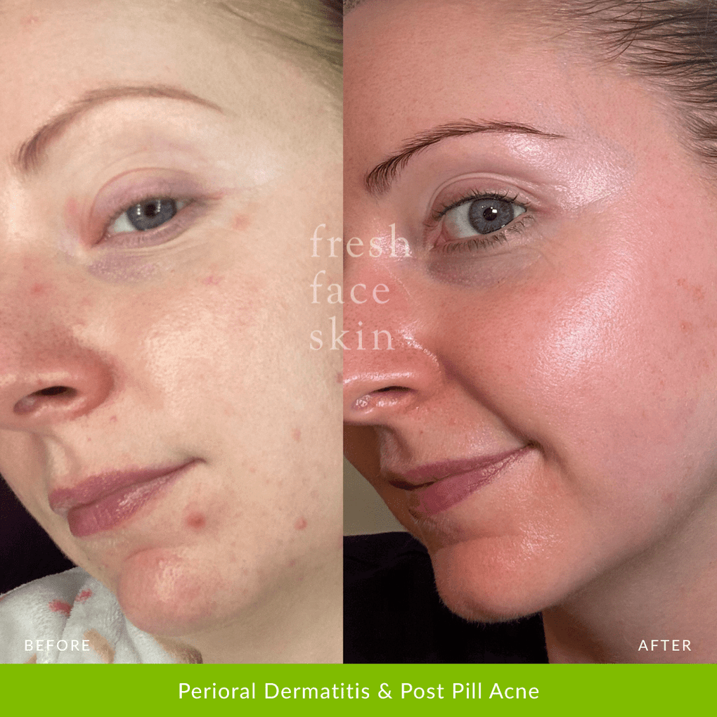 Barrier Mist - Fresh Face Skin