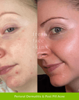 Barrier Mist - Fresh Face Skin