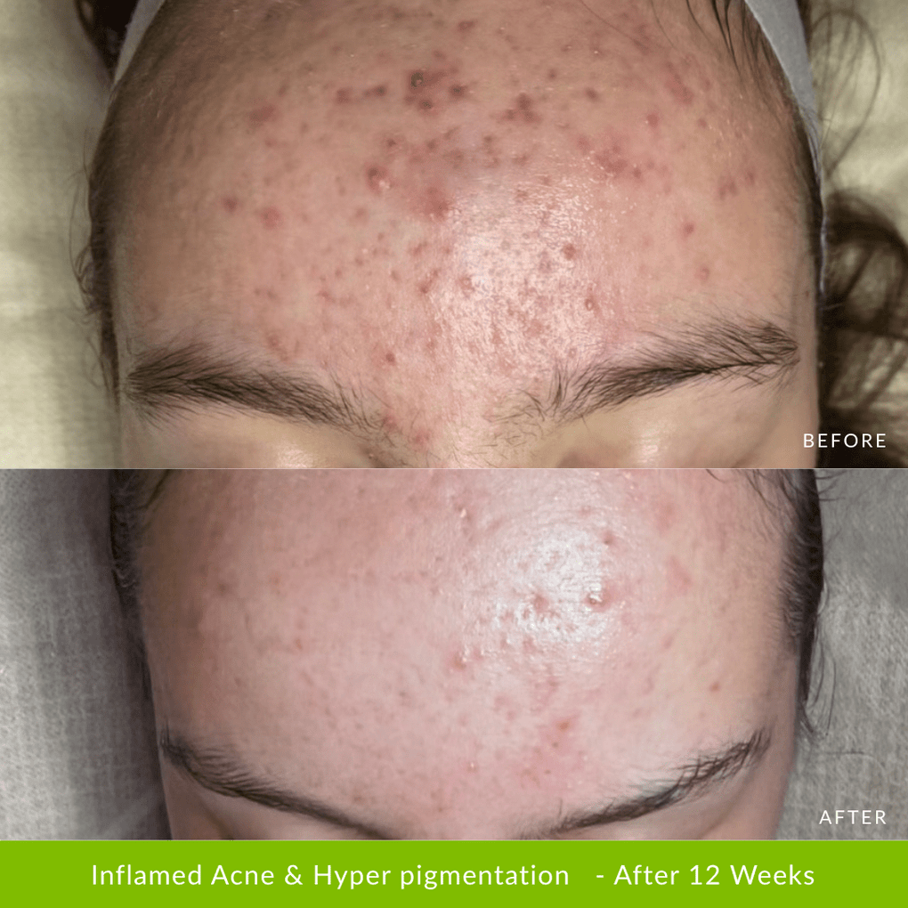 Healer Cleanser - Fresh Face Skin