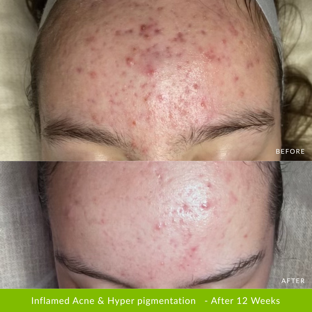 Healer Cleanser