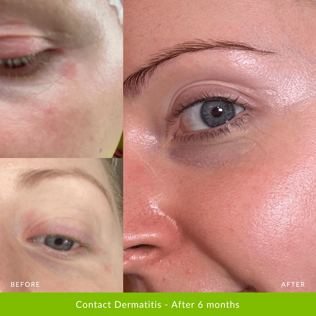 Hydration Duo - Fresh Face Skin