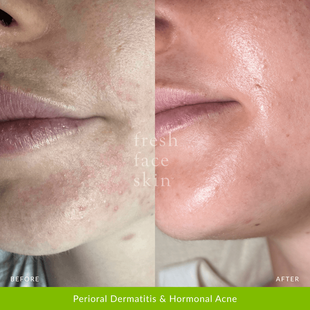 Hydration Duo - Fresh Face Skin