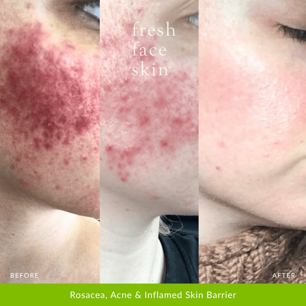 Recovery Mask - Fresh Face Skin