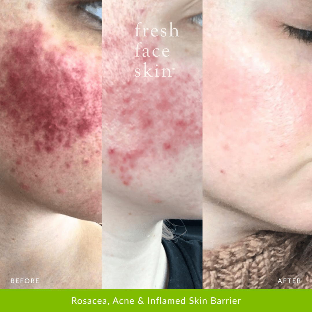 Recovery Mask - Fresh Face Skin
