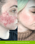 Skin Barrier Repair Pack - Fresh Face Skin