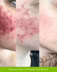 Recovery Mask - Fresh Face Skin
