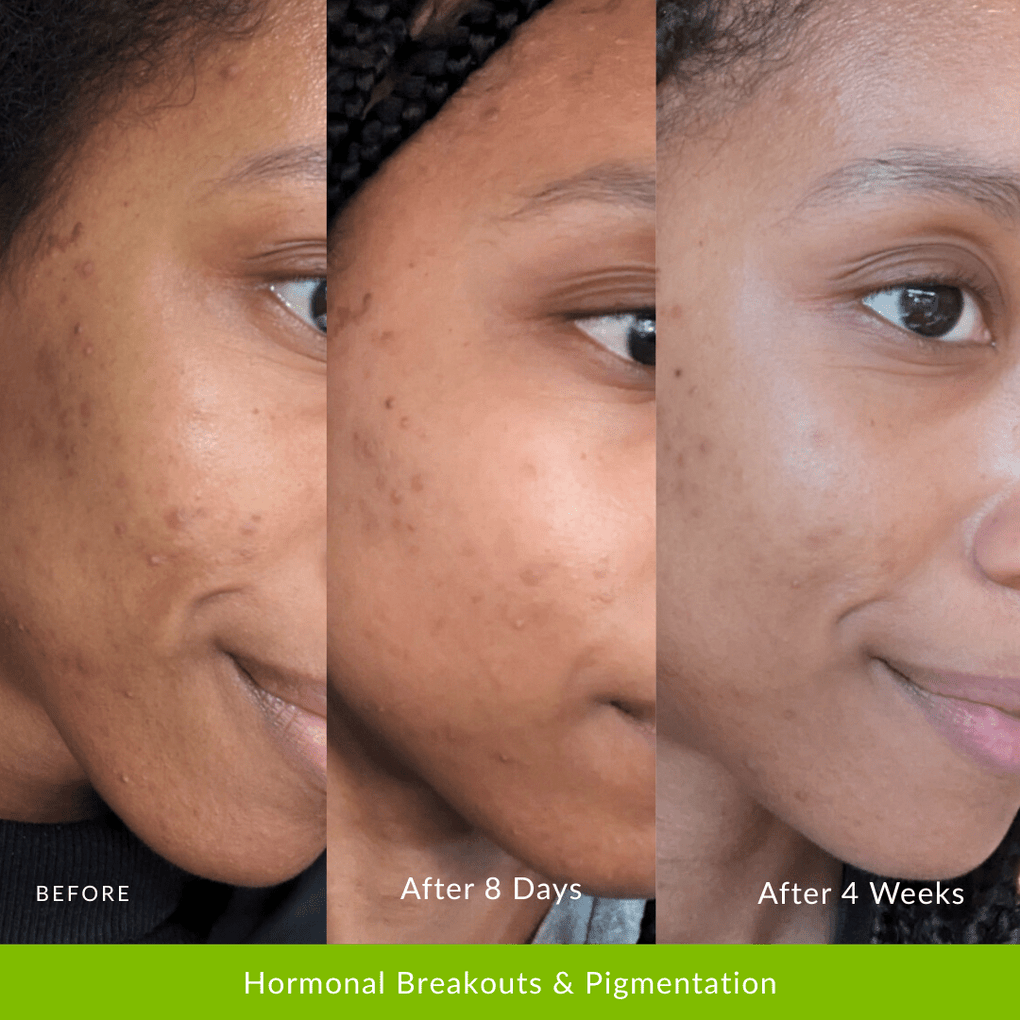 Reverser Treatment - Fresh Face Skin