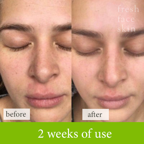 Retained moisture with soother treatment