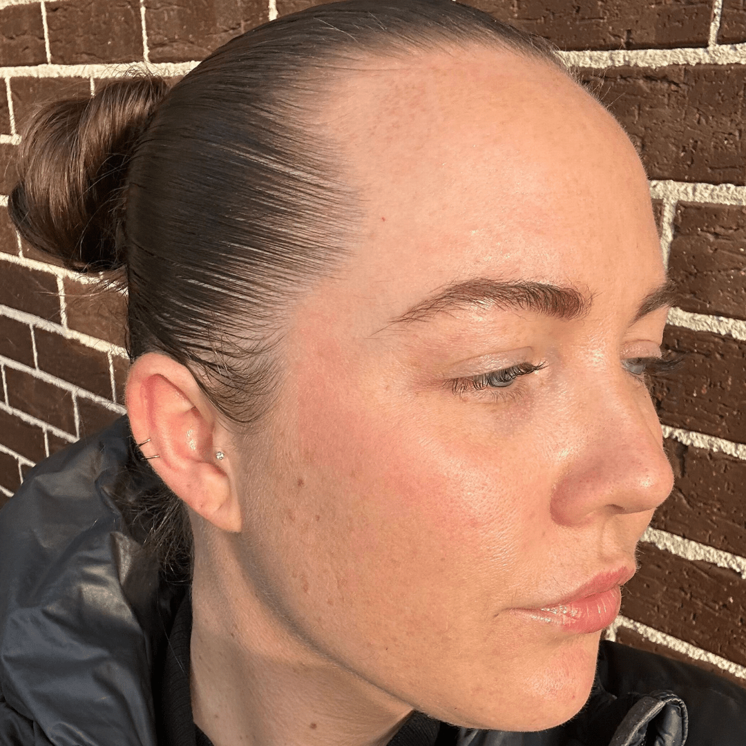 Skin Barrier Repair Pack - Fresh Face Skin