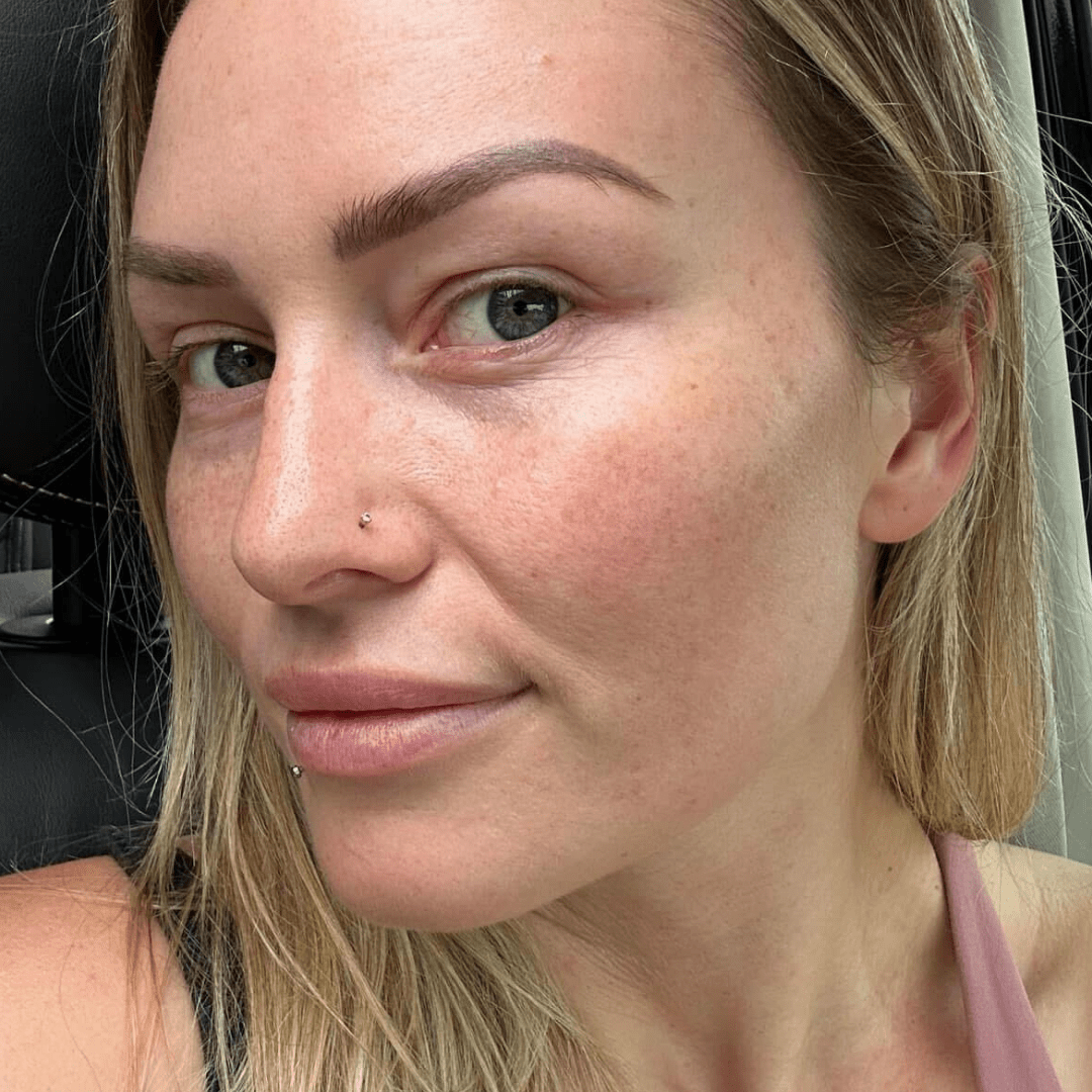 Skin Barrier Repair Pack - Fresh Face Skin