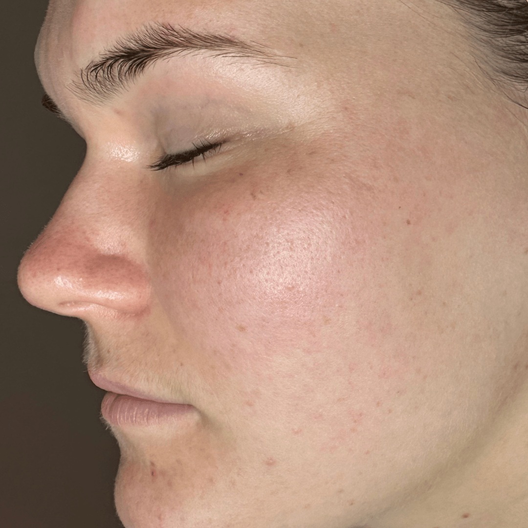 Skin Barrier Repair Pack - Fresh Face Skin