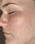 Skin Barrier Repair Pack - Fresh Face Skin