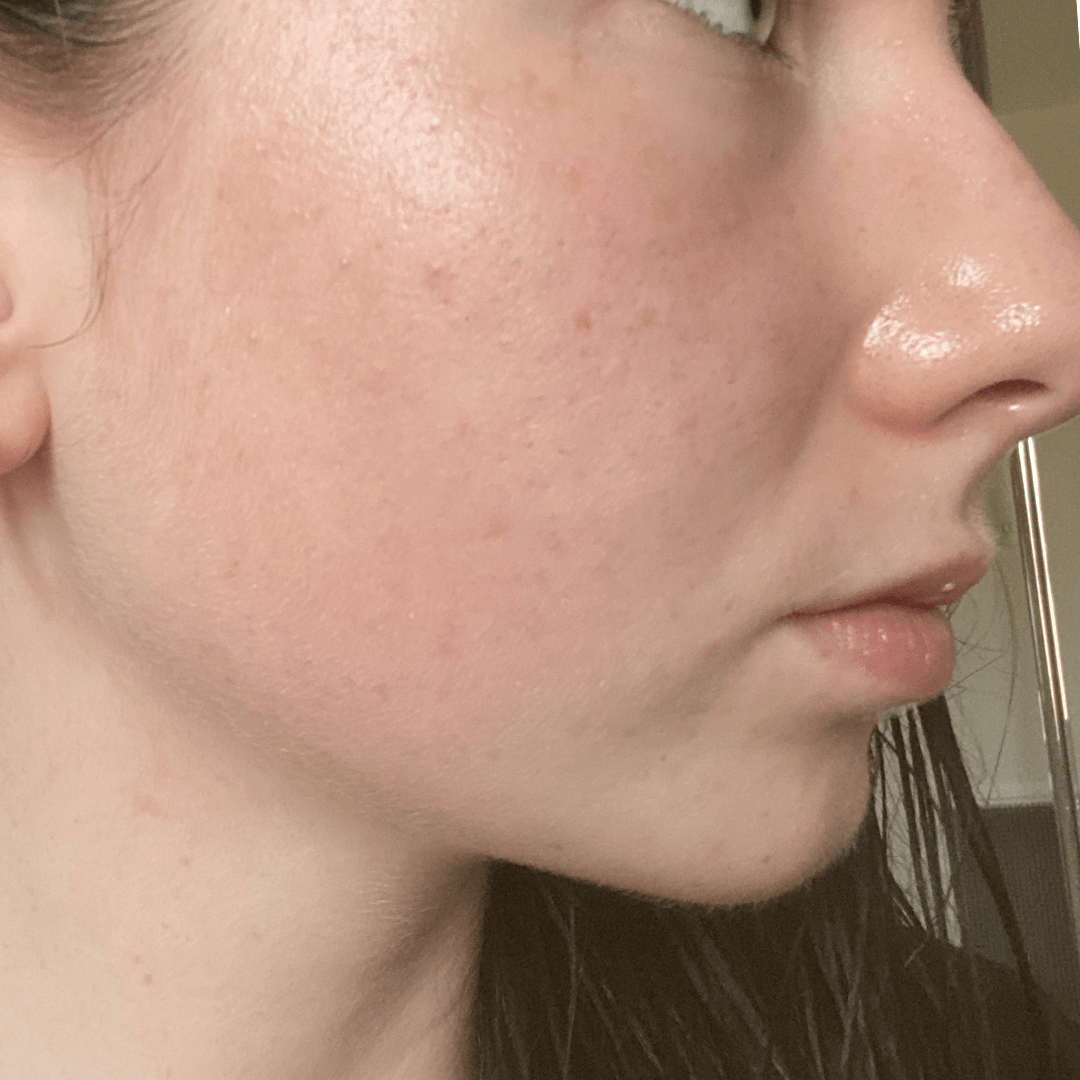 Skin Barrier Repair Pack - Fresh Face Skin