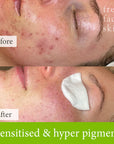 AHA & Enzyme Exfoliator and peel in one